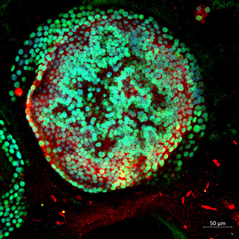 Mikroskopbild einer humanen Alveolarzelle