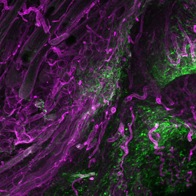 Fascia cells rising into wounds